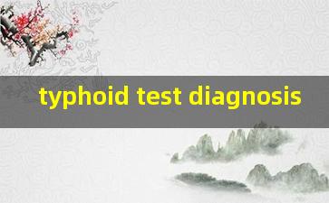 typhoid test diagnosis